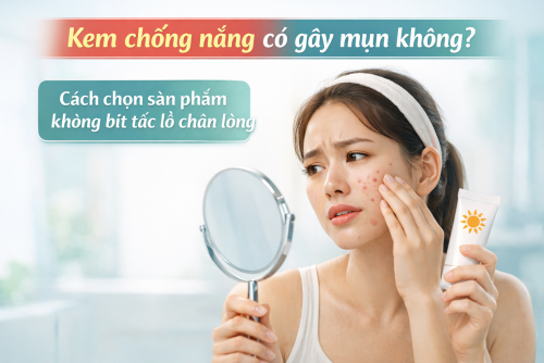 Kem chống nắng có gây mụn không? Cách chọn sản phẩm không bít tắc lỗ chân lông
